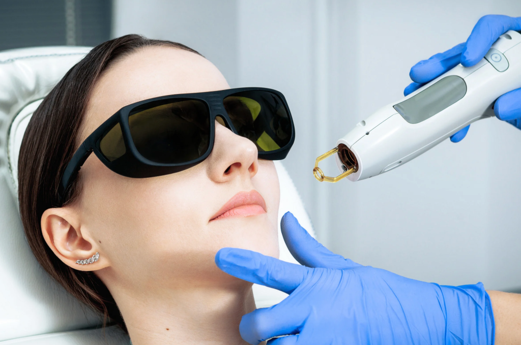 治療師分析雀斑狀況, 激光儀器消除雀斑中