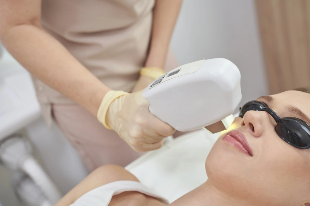 治療師分析雀斑狀況, 彩光去雀斑療程前後, 去雀斑後肌膚顯光滑