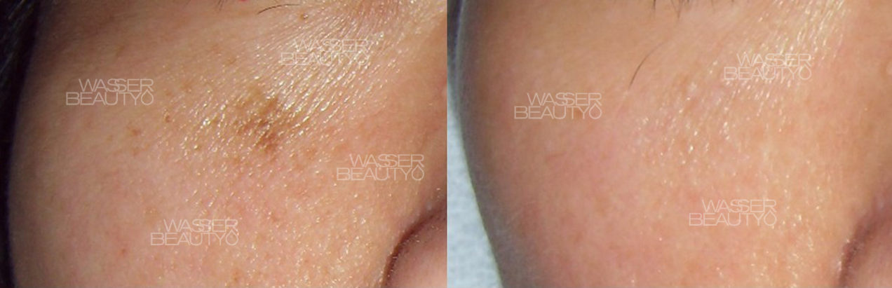 Water B&A Photos (1)