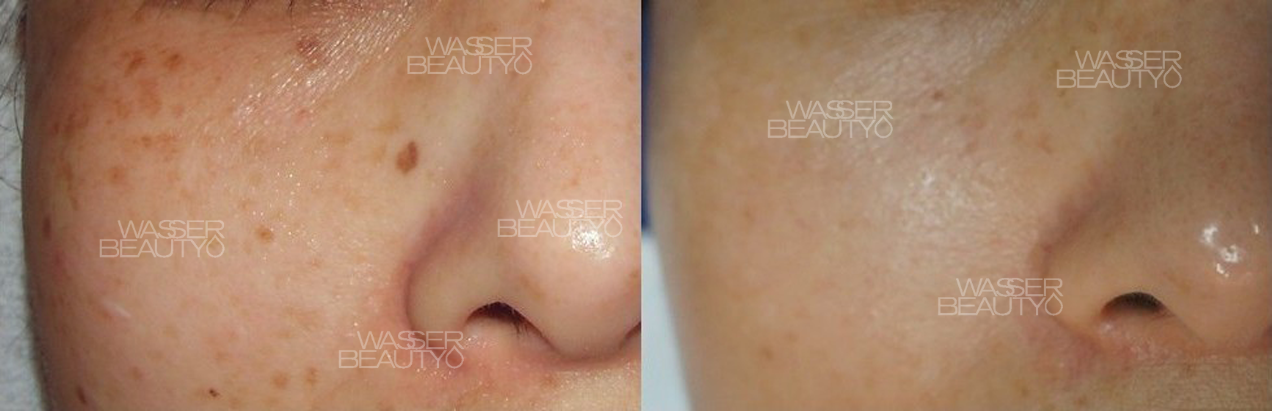 Water B&A Photos (2)