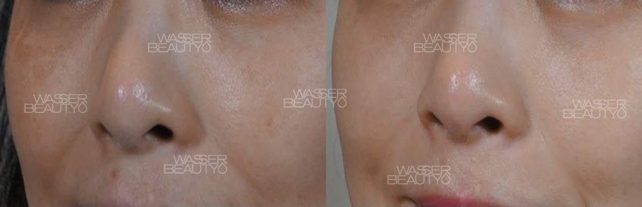 Water B&A Photos (3)