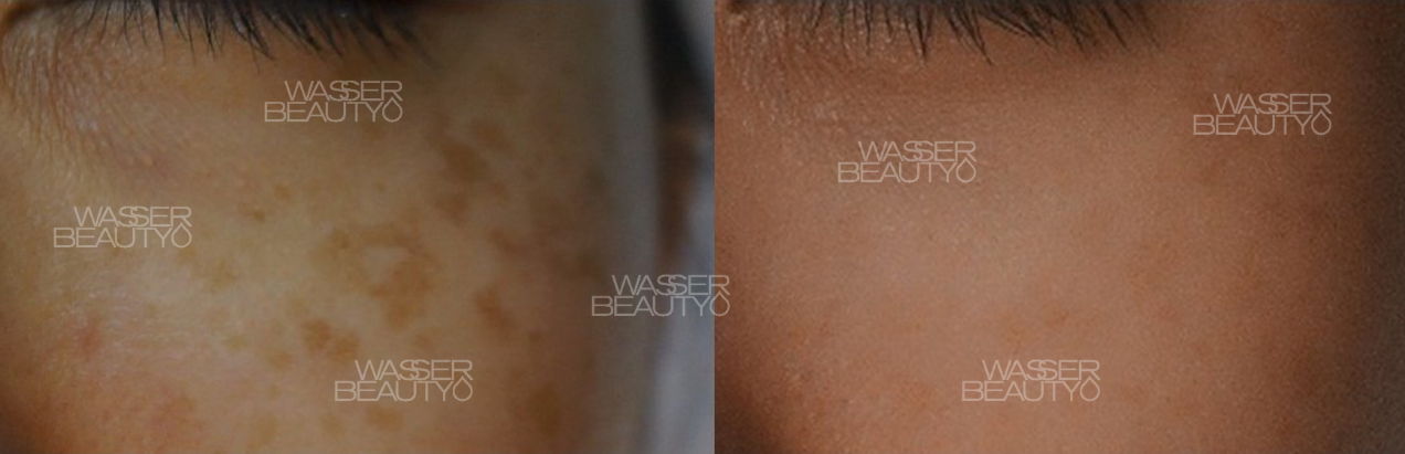 Water B&A Photos (5)