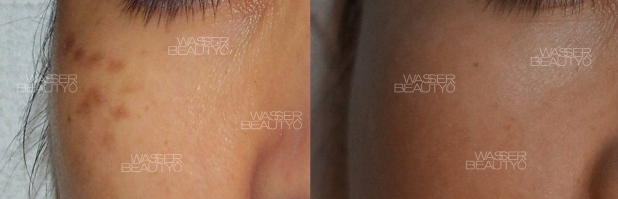 Water B&A Photos (6)