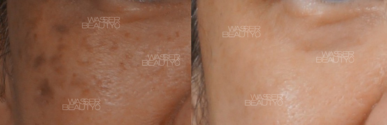 Water B&A Photos (24)