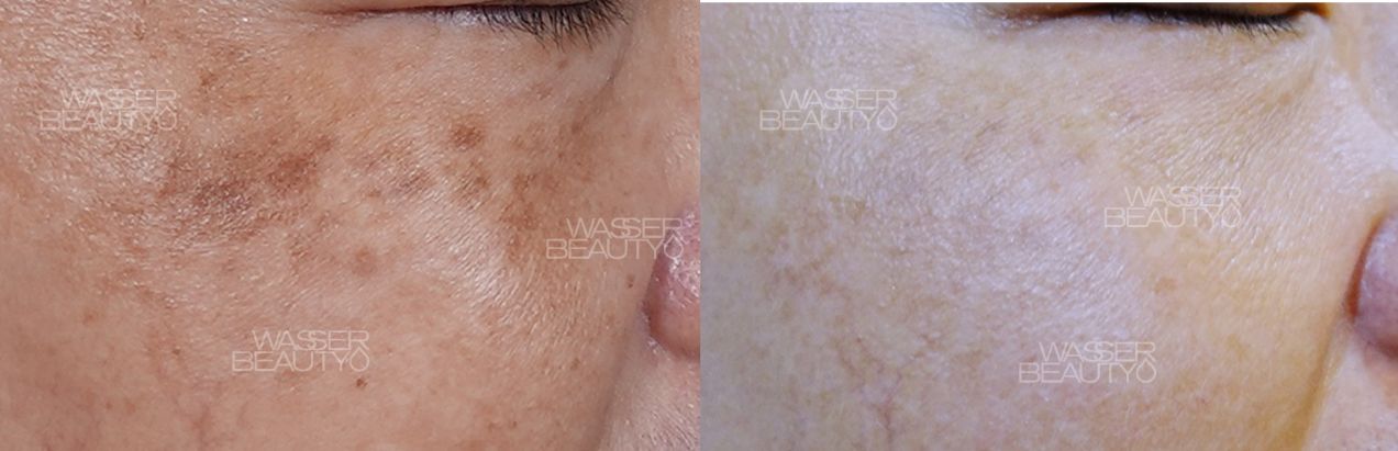 Water B&A Photos (27)