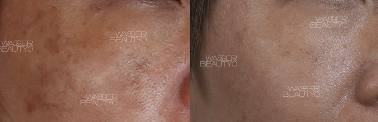 Water B&A Photos (29)