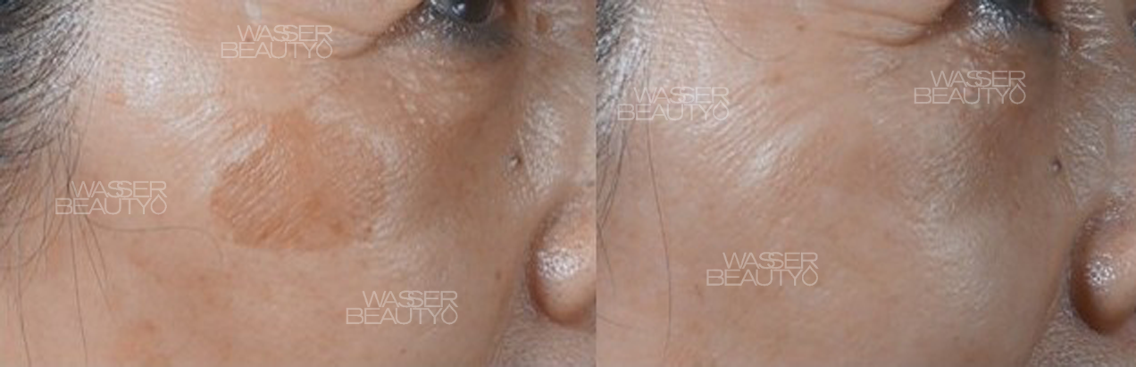 Water B&A Photos (31)