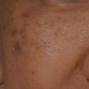 Spot Photos 1024x1024 (10)