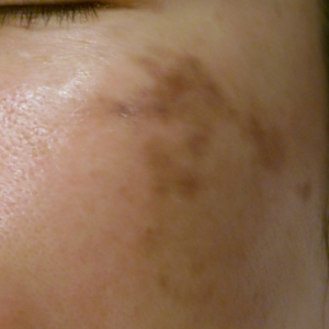 Spot Photos 1024x1024 (11)