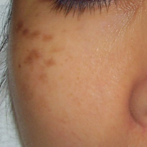 Spot Photos 1024x1024 (14)