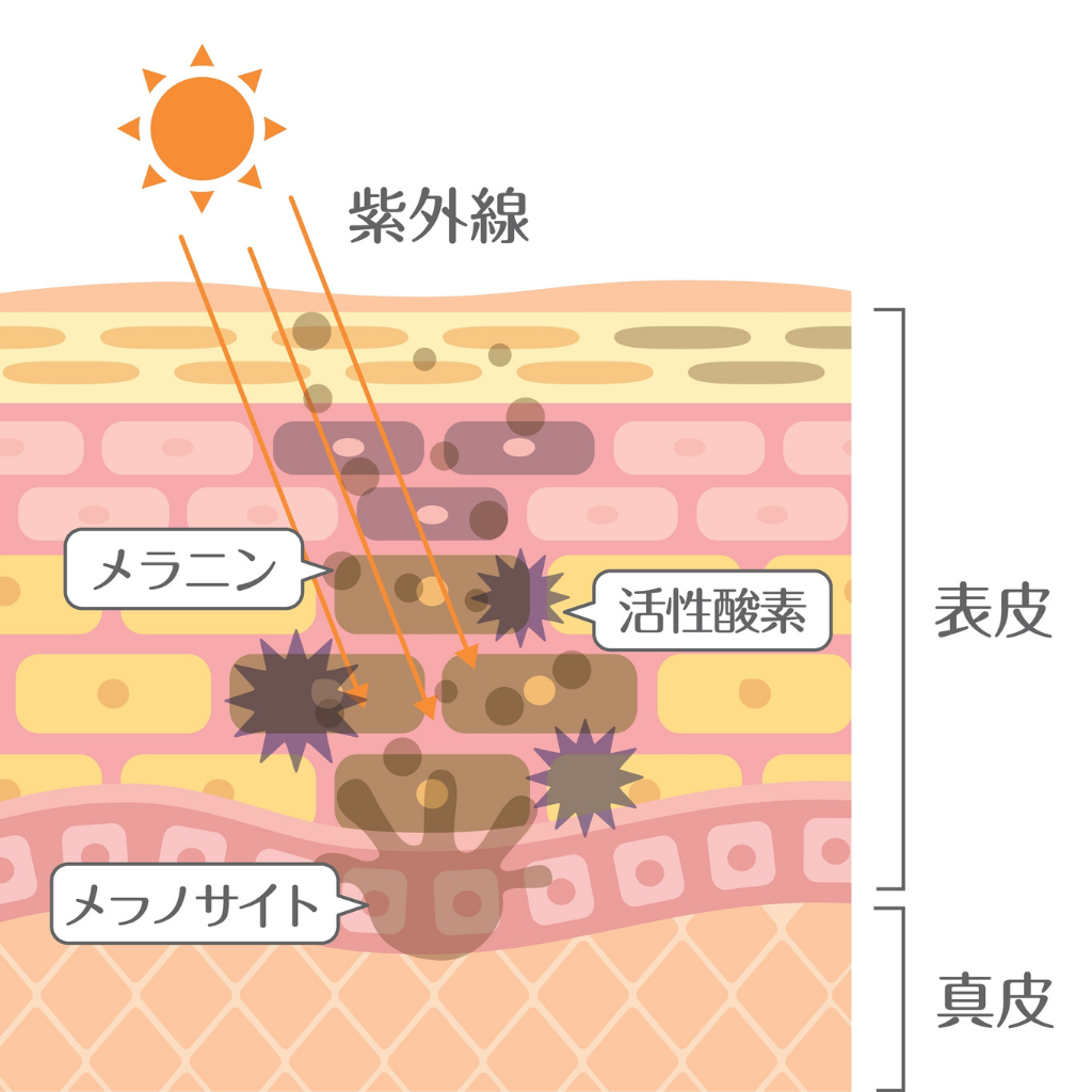 深入了解蝴蝶斑的成因與特徵