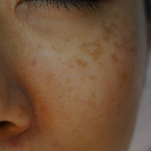 Spot Photos 1024x1024 (5)