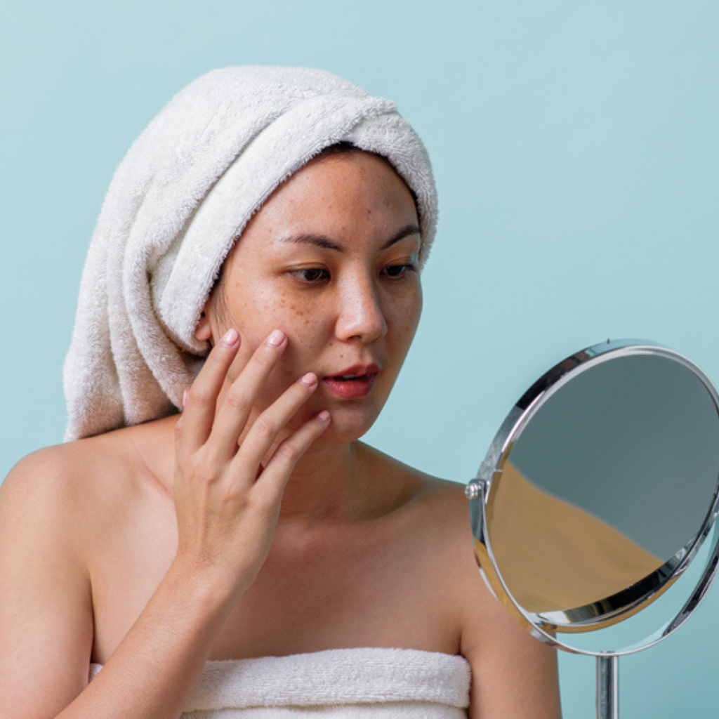 臉頰蝴蝶斑特寫, 蝴蝶斑色素分佈, 美容師去斑諮詢, 雞尾酒式去斑法, 去蝴蝶斑前後對比