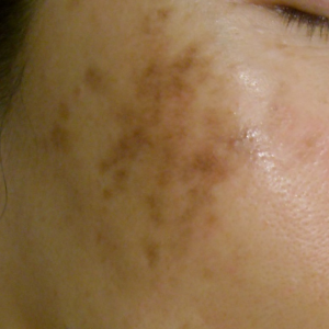 Spot Photos 1024x1024 (9)