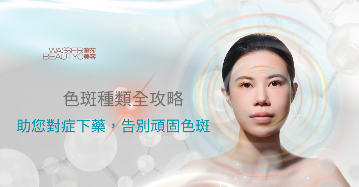 各種面部色斑種類, 紫外線致色斑成因, 專業美容師色斑治療, 皮秒激光去斑儀器, 荷爾蒙斑治療效果