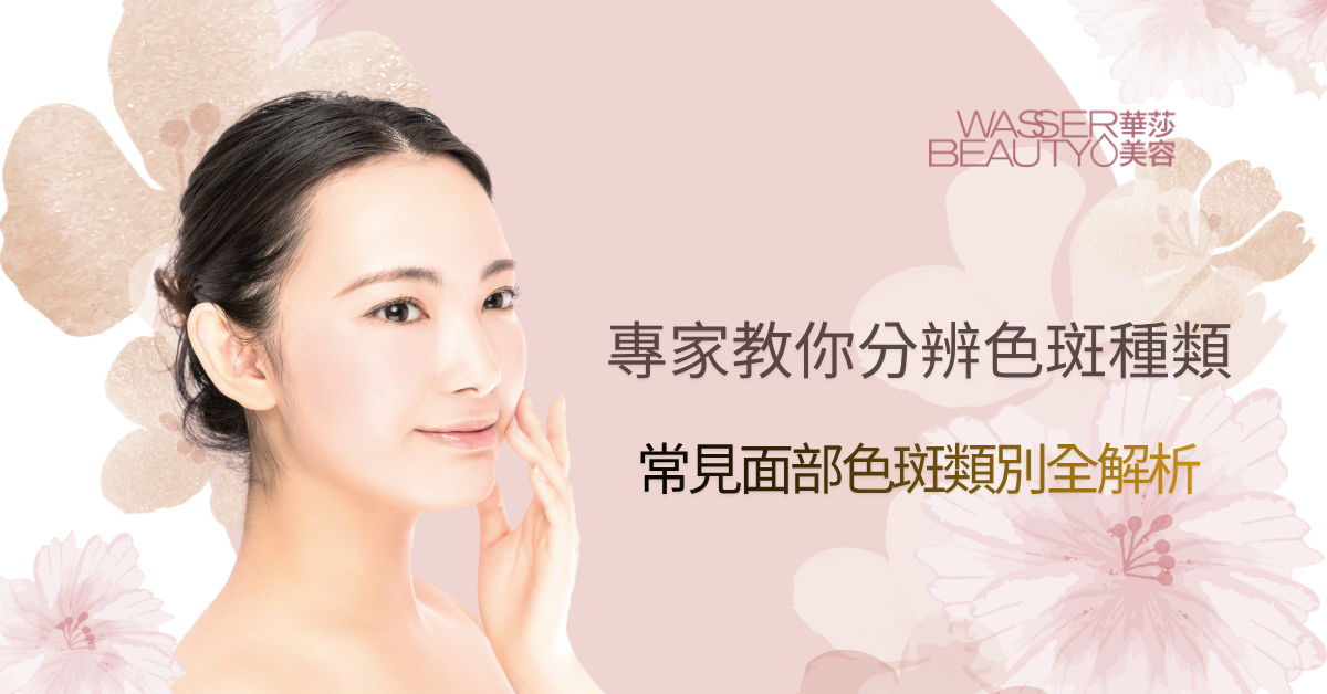 常見面部色斑種類