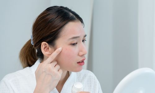 自行使用淡斑產品的潛在風險