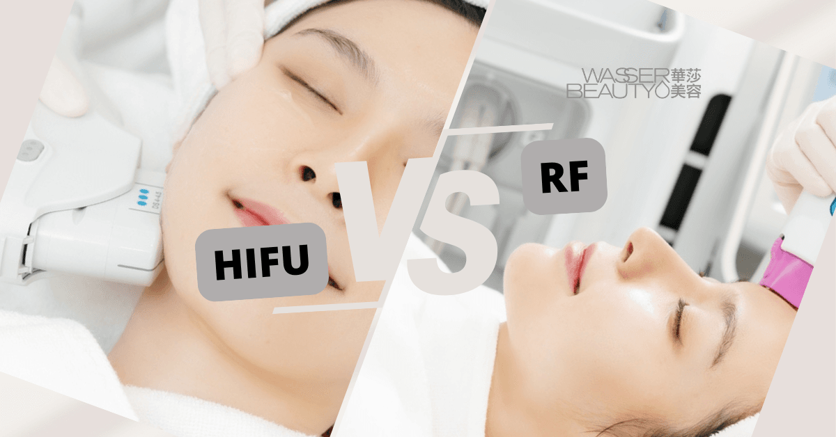 RF HIFU 分別大解析 | 該選哪個？原理、效果一次看懂